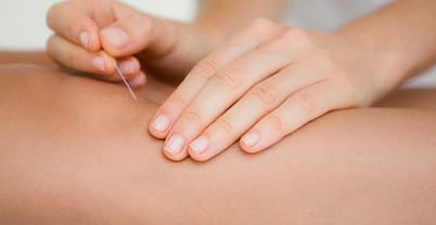 Acupuncture Help Relieve Arthritis